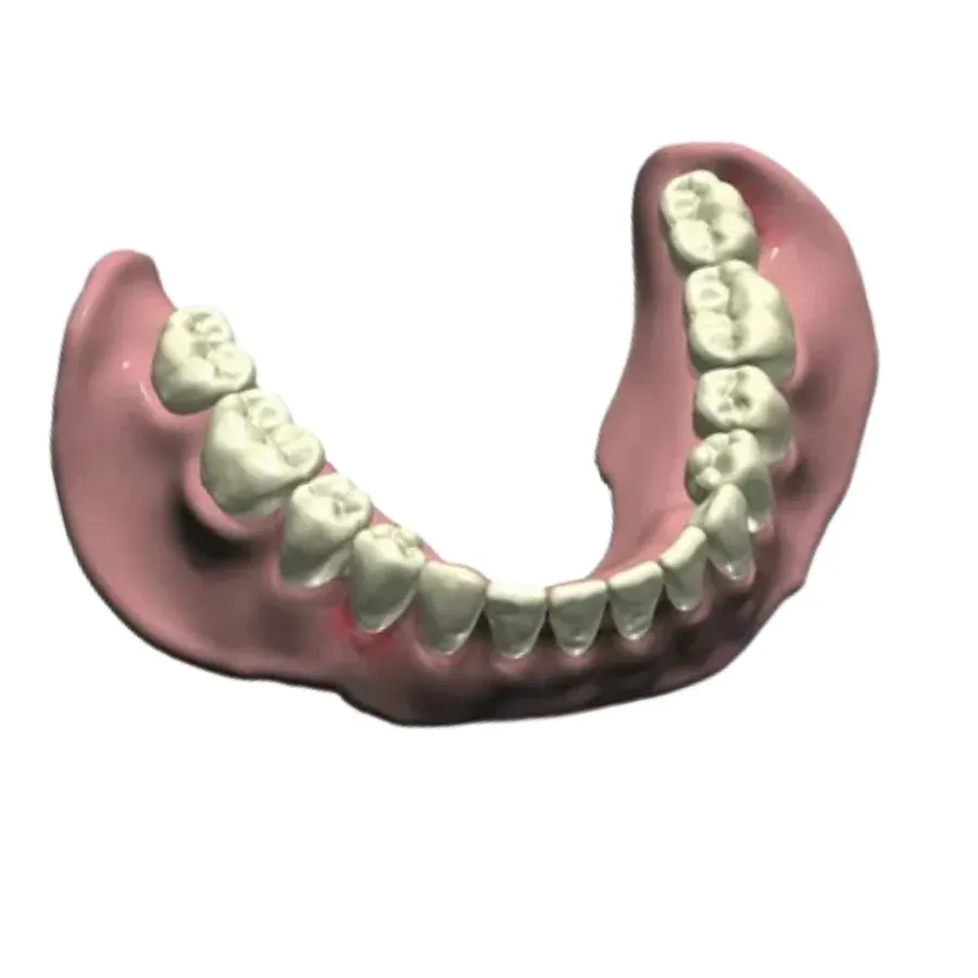CAD/CAM dental design on screen