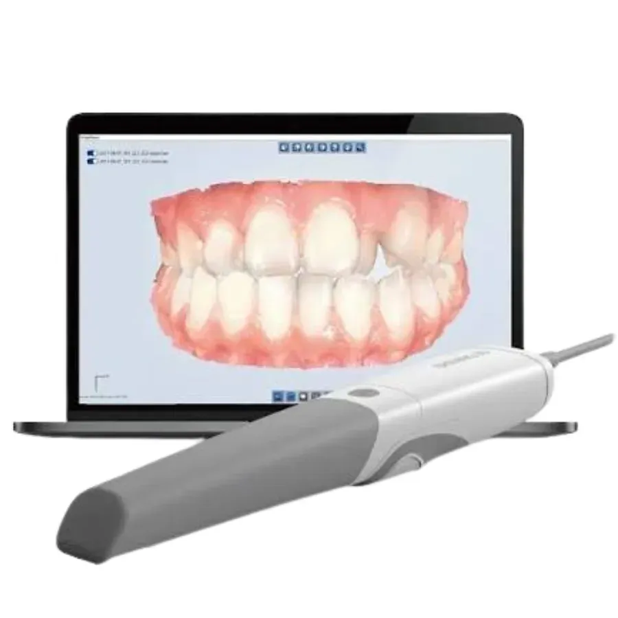 Intraoral scan file processing workflow