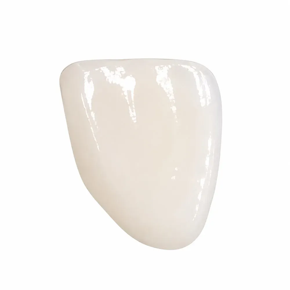 IPS e.max veneers under daylight-balanced light