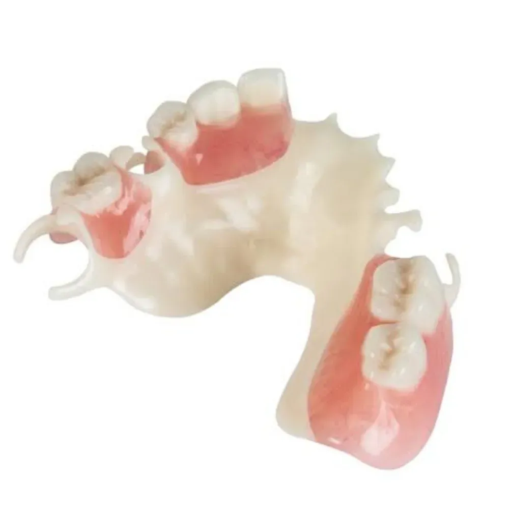Acetal resin partial with tooth-colored clasps on the master model