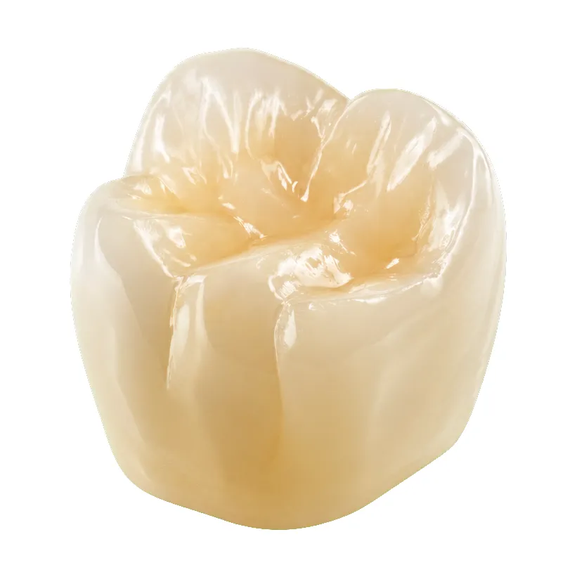 An IPS e.max lithium-disilicate crown, occlusal view.