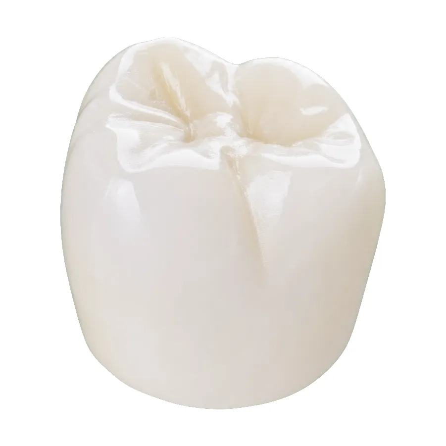 A monolithic zirconia crown, occlusal view.