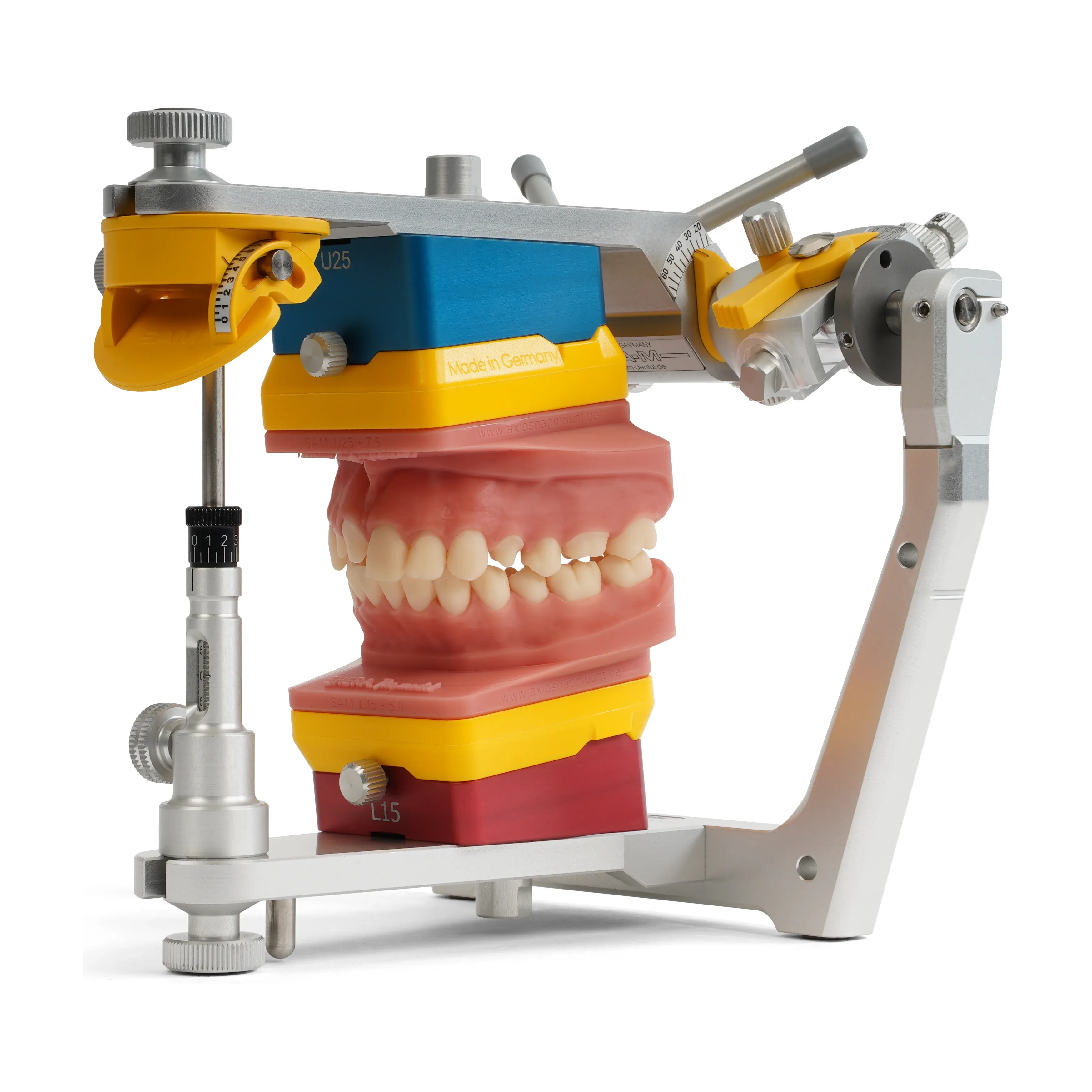 Dental models mounted on a semi-adjustable articulator for a full-mouth reconstruction.