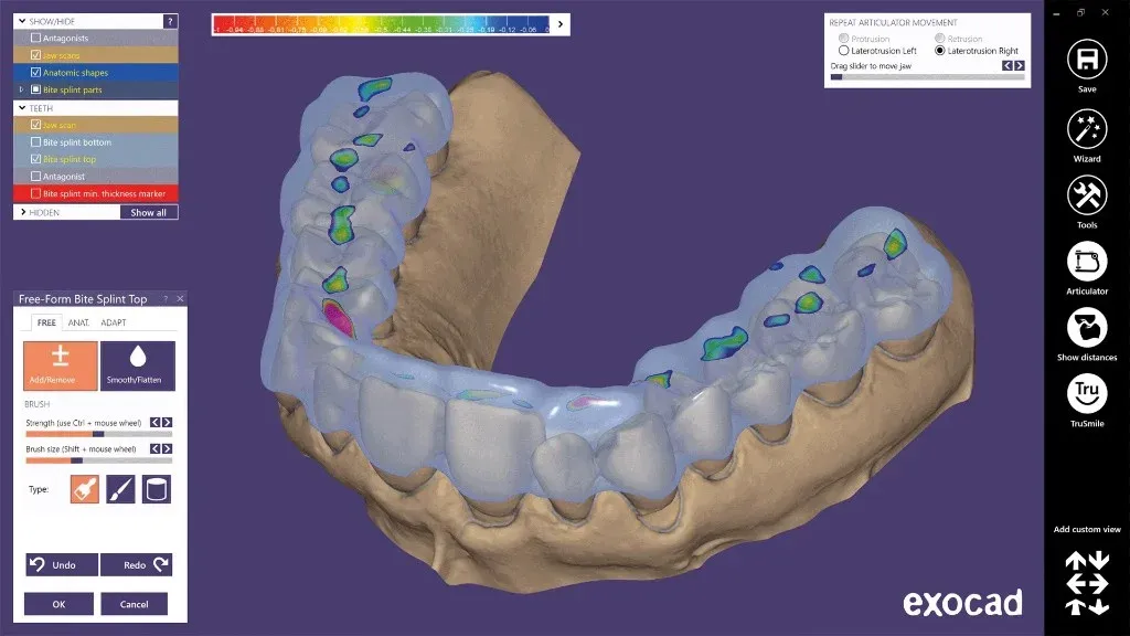 A Comfort3D guard being designed in CAD against the scanned opposing arch