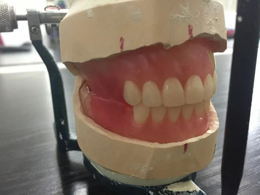 Complete denture and partial framework for group removable volume