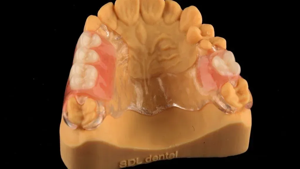 A printed flexible partial with tissue-toned clasps on the model