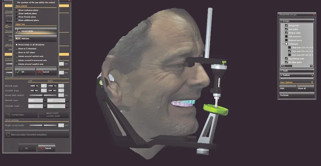 Articulated full-mouth case under review on the bench