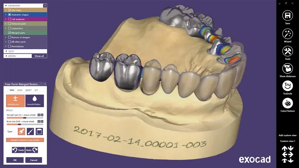 CAD workstation with a restoration open on screen, intraoral scan loaded alongside