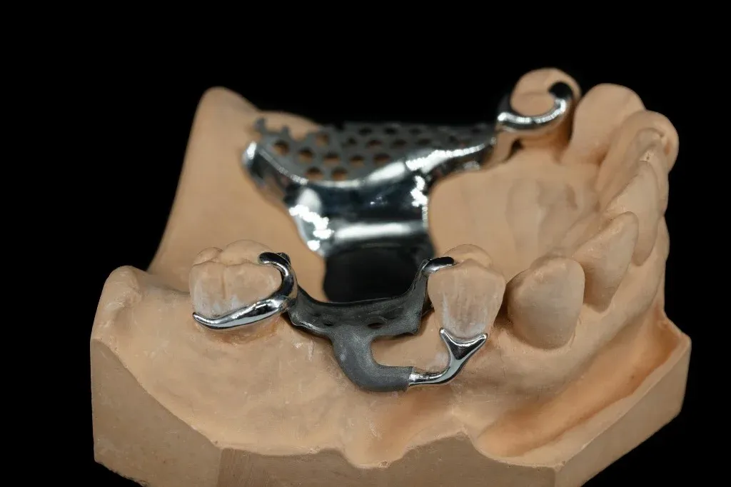 Cast cobalt-chromium partial denture framework on a model
