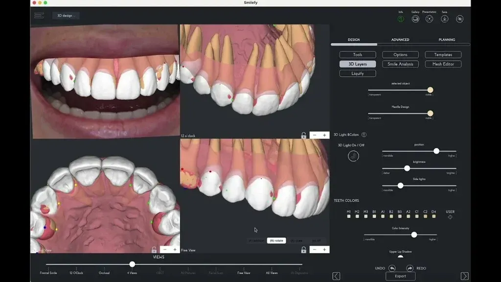 Ceramist reviewing anterior patient photographs and a shade reference against the intraoral scan on screen