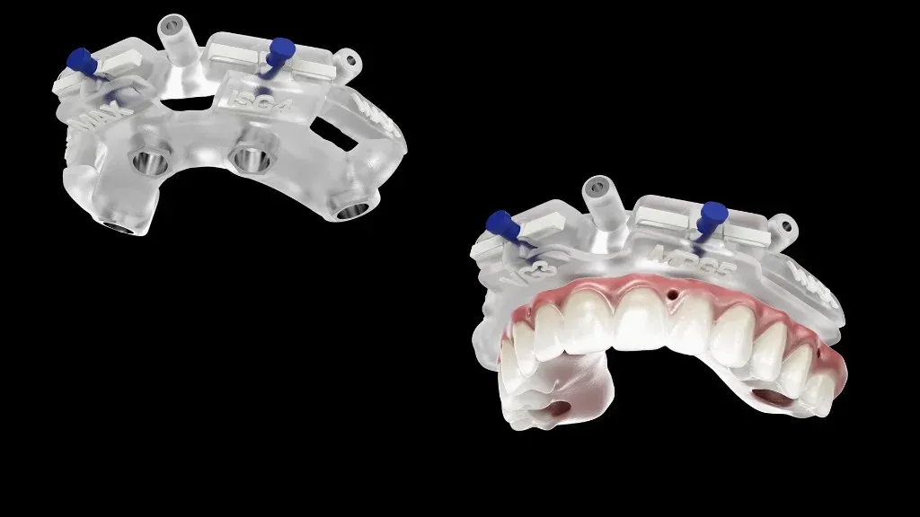 Full-arch reduction guide and surgical placement guide staged together on the model