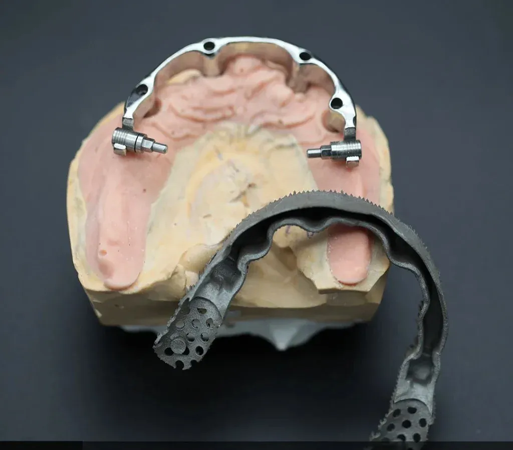 Full-arch implant restoration on a verified framework