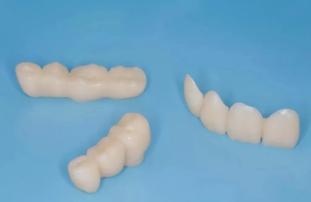 Monolithic zirconia bridge milled for a multi-unit span