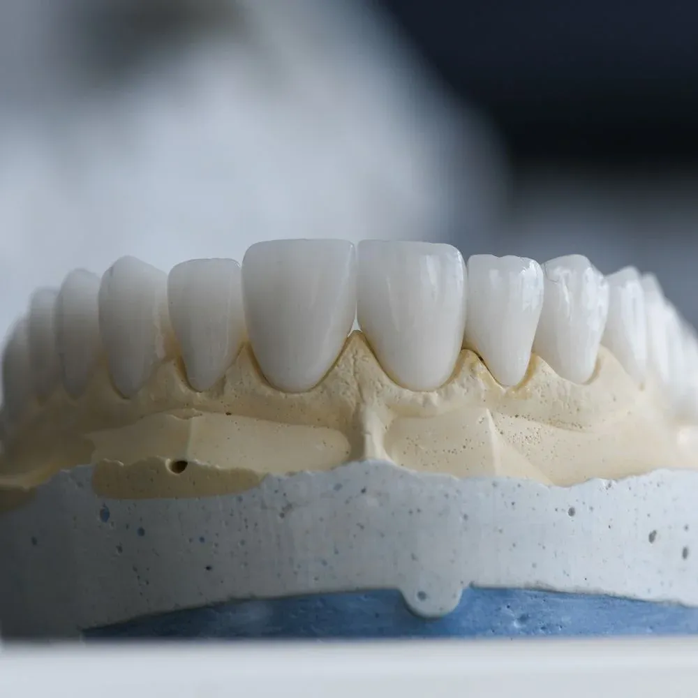 Finished crowns and a ceramic bridge for fixed restorative work