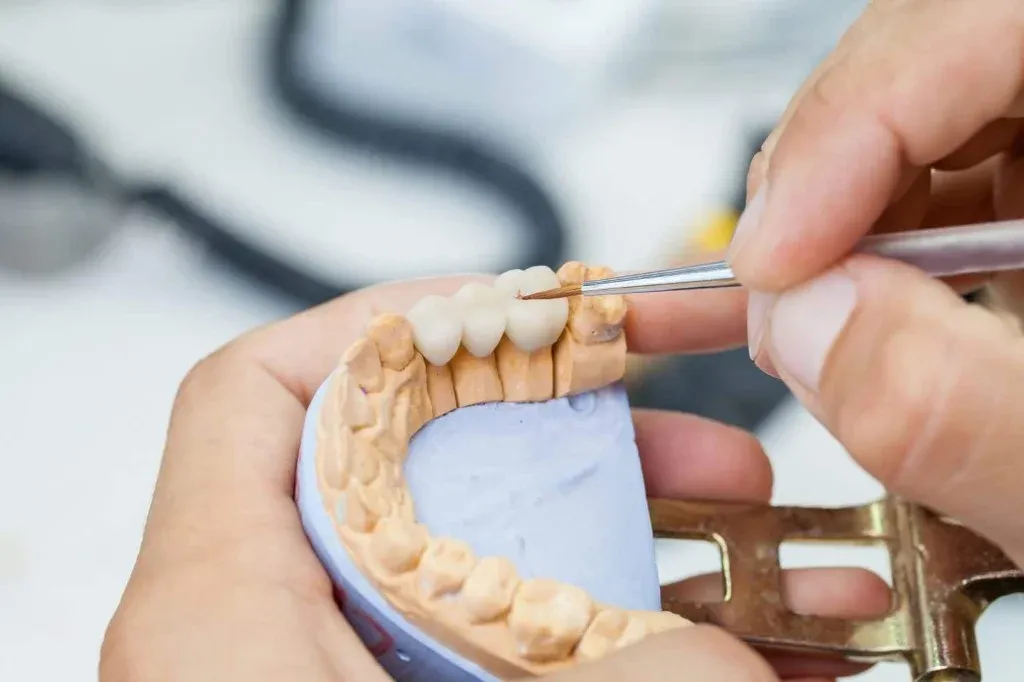 A ceramist layering porcelain across a metal bridge framework