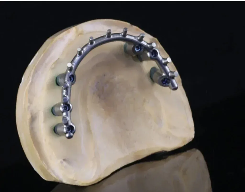 A fixed implant bar screwed down one implant at a time on the master model