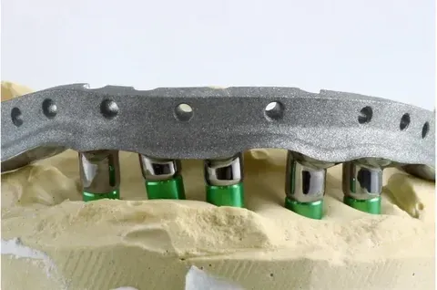 A multi-unit implant framework checked for passive seating