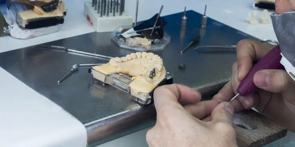A technician fit-checking a cast base-metal crown on the die