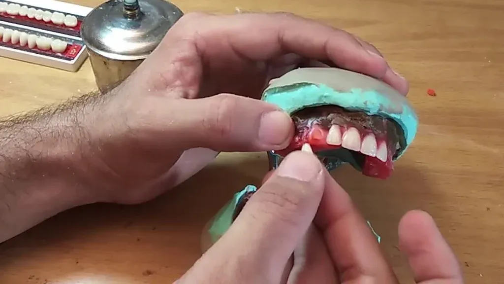 A technician setting denture teeth to the jaw relation records