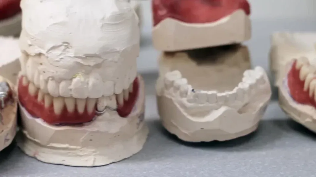 A technician setting denture teeth to the prescribed occlusion