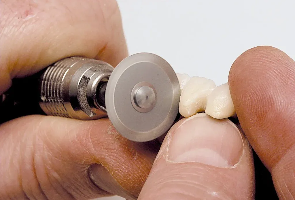 A technician verifying connector and margin fit across a milled bridge on the model