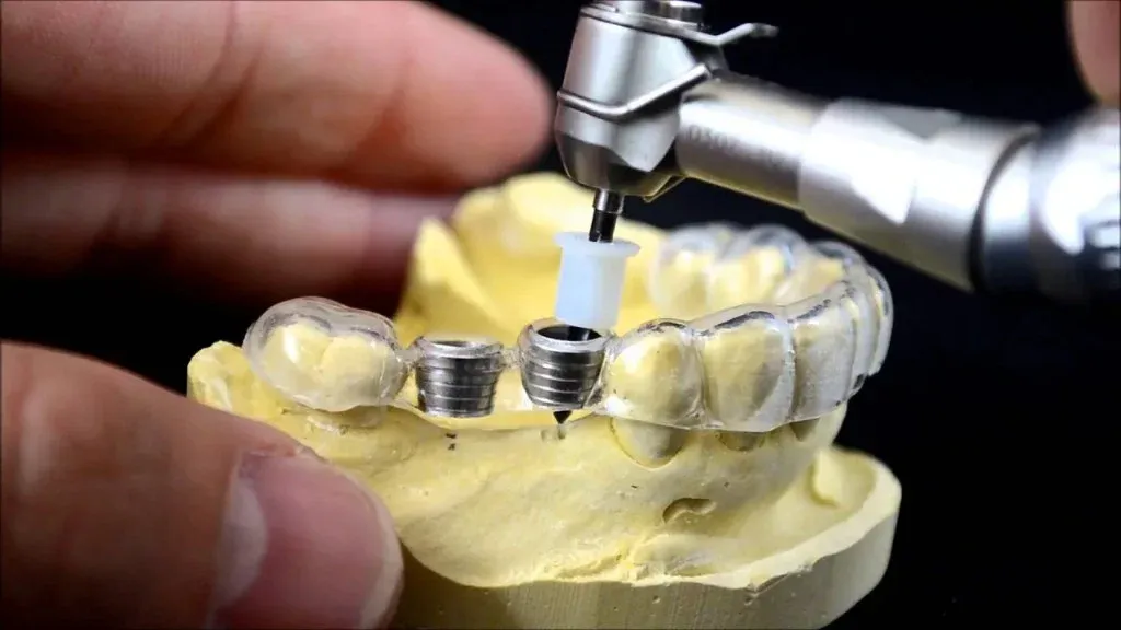 Printed surgical guide with seated metal sleeves being inspected on the model
