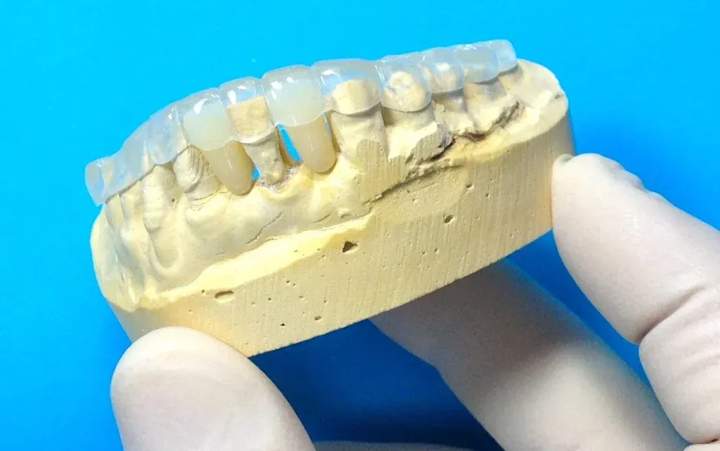 Putty matrix and a printed trial shell shown side by side on the bench