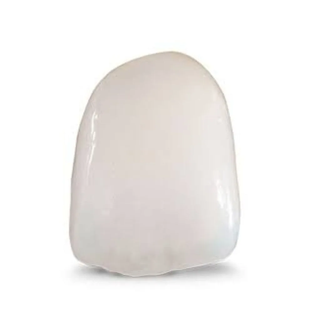 Porcelain-fused-to-zirconia crown