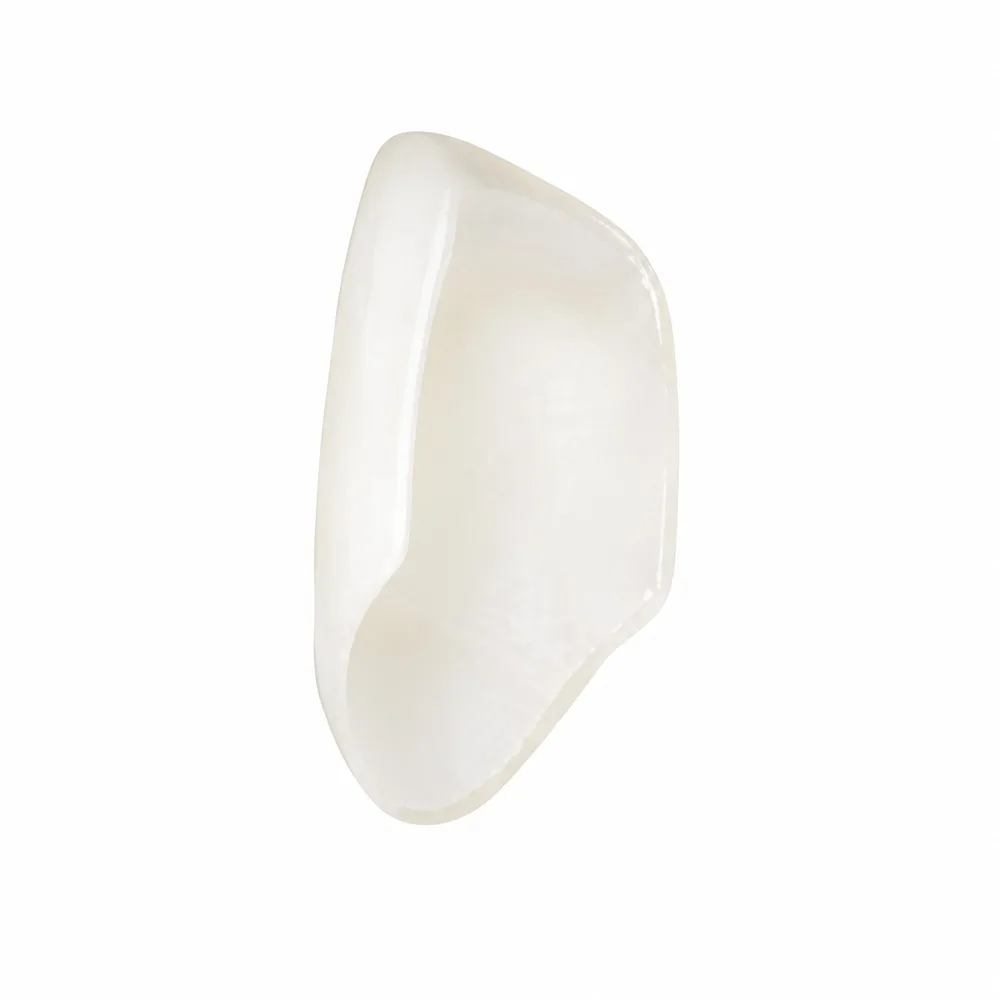 Hand-layered porcelain veneers